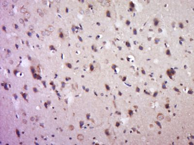 Phospho-Paxillin(Ser83) antibo