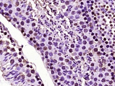 Phospho-Histone H2A.X (Tyr143)