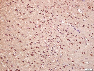 Phospho-P38 MAPK (Thr180 + Tyr