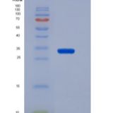 人CD19 / Leu-12重组蛋白His tag