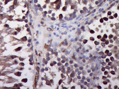 Phospho-Cofilin (Ser3) antibod