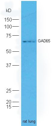 GAD65谷氨酸脱羧酶-65抗体