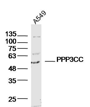PPP3CC antibody