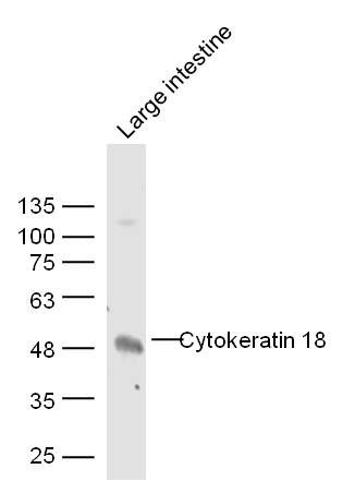 Cytokeratin 18细胞角蛋白18抗体