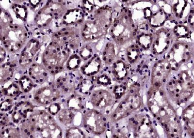 Phospho-Histone H3 (Thr11) ant