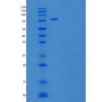 人乳铁传递蛋白(LTF)重组蛋白C-6His