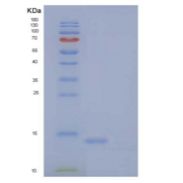 人CDO兄弟同源物(BOC)重组蛋白C-6His