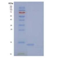 人CDO兄弟同源物(BOC)重组蛋白C-6His