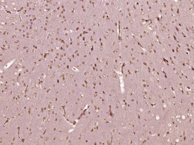 Nucleophosmin antibody