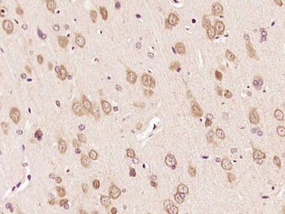 phospho-ERK1/2 (Thr202 + Tyr20