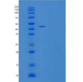 人白细胞免疫球蛋白样受体A3/LILRA3/ILT6/CD85e重组蛋白C-6His