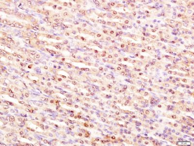 p53 (FL-393)肿瘤抑制基因p53抗体