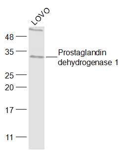 Prostaglandin dehydrogenase 1 