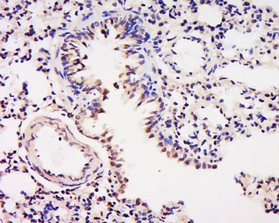 ELK1细胞转录因子ELK1抗体