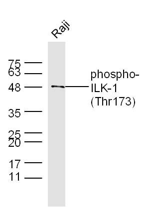 phospho-ILK-1(Thr173) antibody