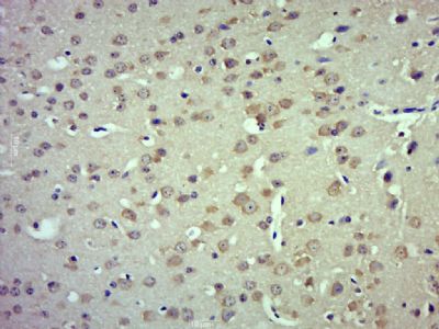 TRPM4 antibody