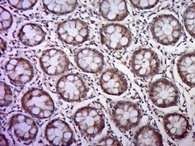 Cytokeratin 18细胞角蛋白18抗体