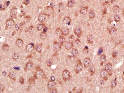 GAT1/GABA Transporter 1 γ氨基丁酸运