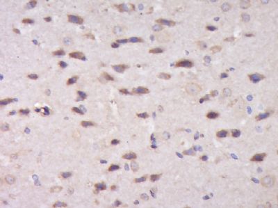 phospho-Tau protein (Ser198)磷