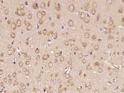 RNF170环指蛋白170抗体