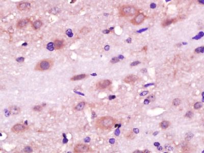 RLBP1L1视黄醛结合蛋白1抗体