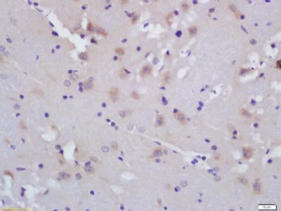 FLAP 5脂氧合酶激活蛋白抗体