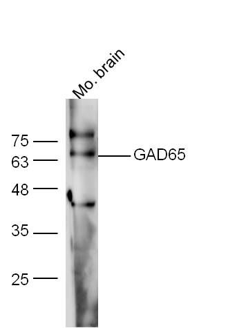 GAD65谷氨酸脱羧酶-65抗体