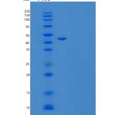 小鼠清道夫受体B2/SR-B2/LIMPII/CD36L2重组蛋白C-Fc