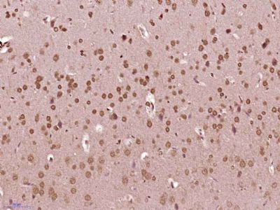 phospho-Src (Ser75) antibody