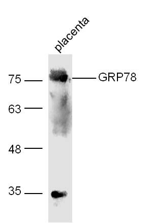 GRP78葡萄糖调节蛋白78抗体（热休克蛋白70蛋白5）