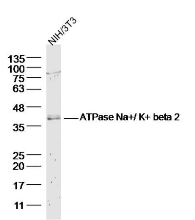 ATPase Na+/ K+ beta 2钠钾ATP酶通道蛋