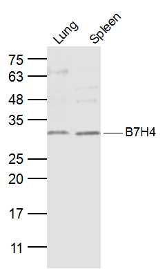 B7H4 antibody