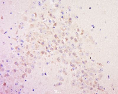 phospho-Tau protein (Ser198)磷