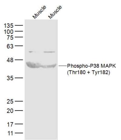 Phospho-P38 MAPK (Thr180 + Tyr