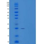人RANKL / OPGL / TNFSF11 / CD254重组蛋白