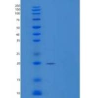 人RANKL / OPGL / TNFSF11 / CD254重组蛋白