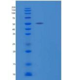 人杀菌通透性增加蛋白/BPI/CAP57重组蛋白C-6His