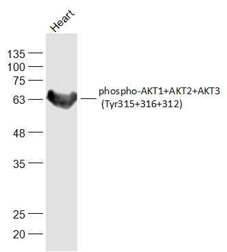 phospho-AKT1+AKT2+AKT3 (Tyr315