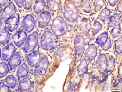 IL-2白介素2抗体