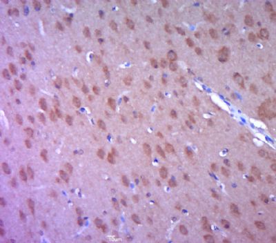 phospho-SYN1(Ser62+Ser67) anti