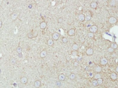 KCNMA1/BK channel antibody