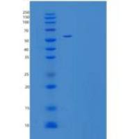 人芳基硫酸酯酶A(ARSA)重组蛋白C-6His