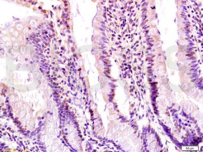 Egr1早期生长应答蛋白1靶向蛋白1抗体