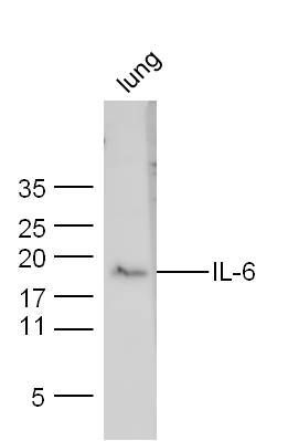 IL-6 antibody