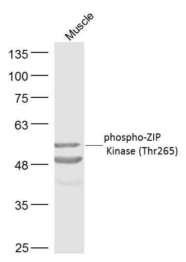 phospho-ZIP Kinase (Thr265)磷酸化