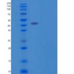 人CD40/TNFRSF5/CD40L受体重组蛋白