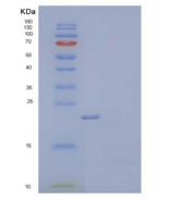 人胞浆磷蛋白1(STMN1)重组蛋白C-6His