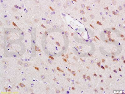 HSP70热休克蛋白-70抗体