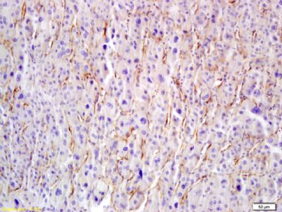 Hyaluronidase-1 antibody