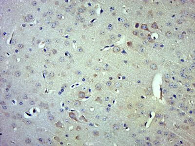 ITCH/AIP4 antibody